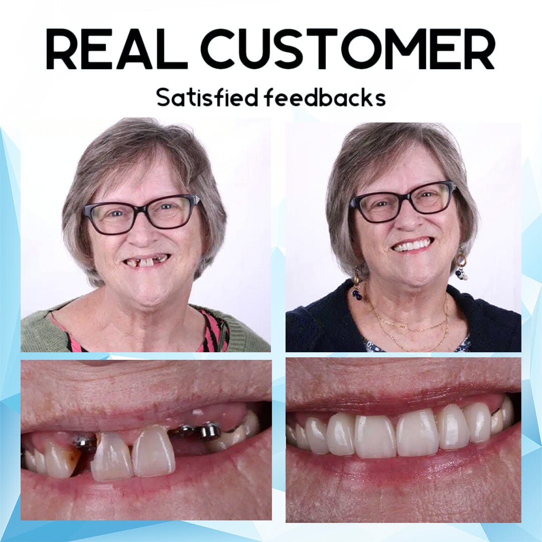 Furzero™ Silicone Reline Denture Set🦷 🦷 🦷