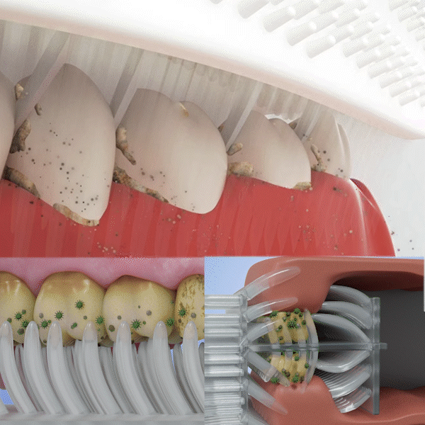 Remifa⢠SpeedySmile EZBrush 360 U-Shape Toothbrush