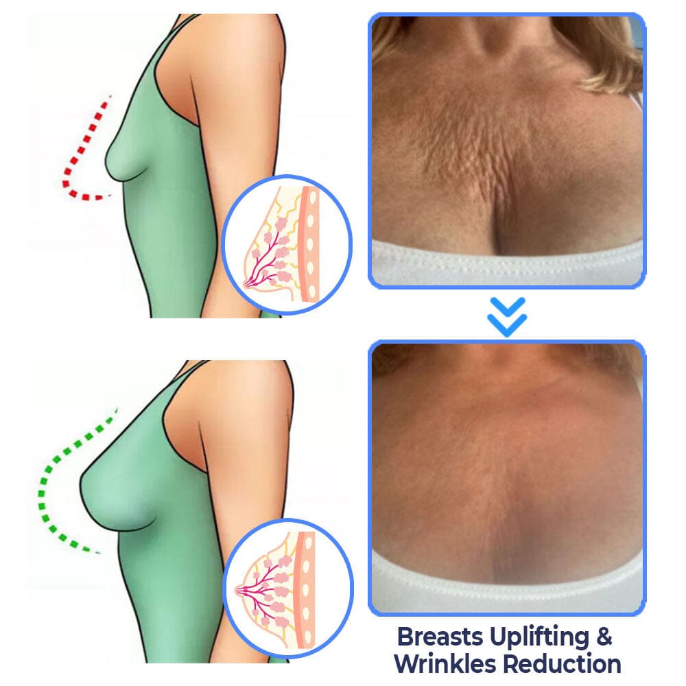 flysmus™ Advanced Tightening & Wrinkles Reducing Lotion (LAST DAY 40% OFF)🌈