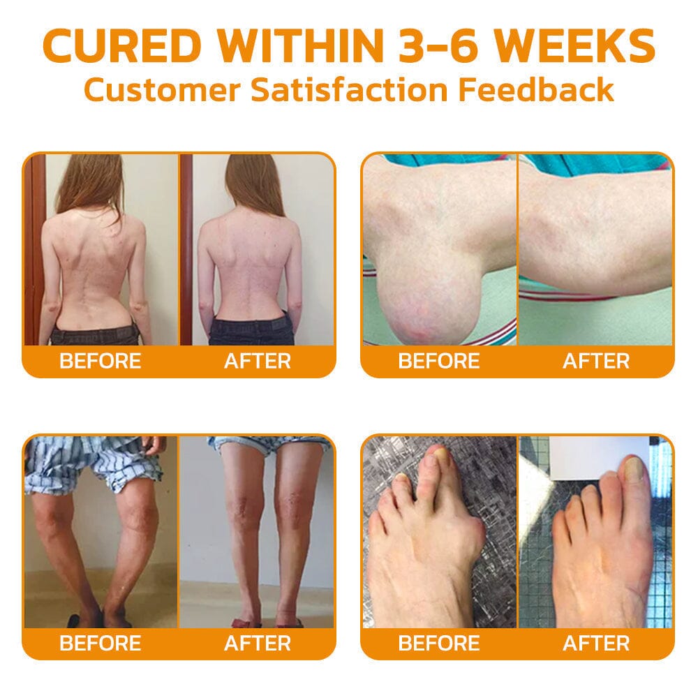 🇺🇸 Furzero™ Bee Venom Pain Suppression Joint Healing Cream (AAOS)Approved(Reducing joint swelling, pain, stiffness, redness, warmth, soreness, and joint fatigue)