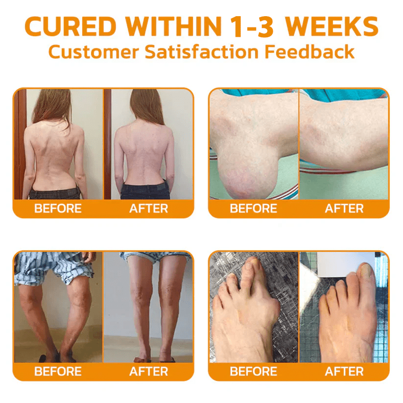 ✅Official Store: flysmus™ Lidocaine Scar-Free Pain Relief Healing Liquid👨‍⚕️USA Osteopathic Medical Association （AAOS）Approved(Reducing joint swelling, pain, stiffness, redness, warmth, soreness,  joint fatigue and remove scars)