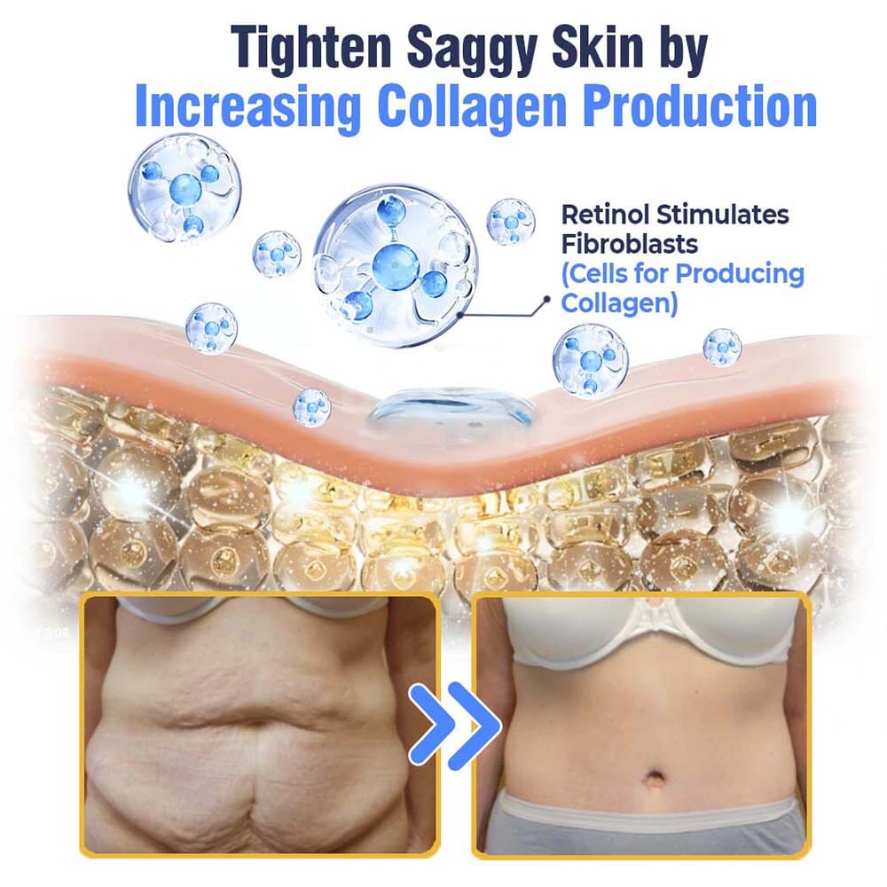 flysmus™ Advanced Tightening & Wrinkles Reducing Lotion (LAST DAY 40% OFF)🌈