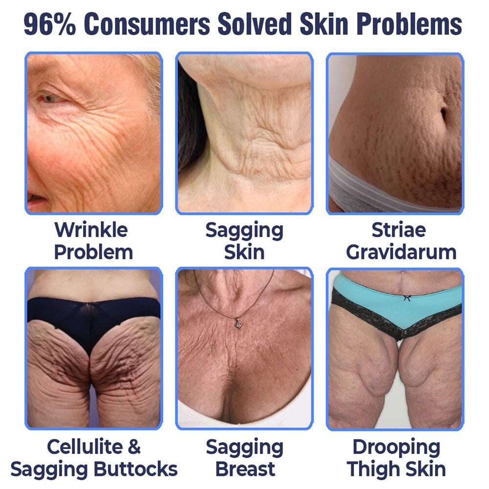 flysmus™ Advanced Tightening & Wrinkles Reducing Lotion (LAST DAY 40% OFF)🌈