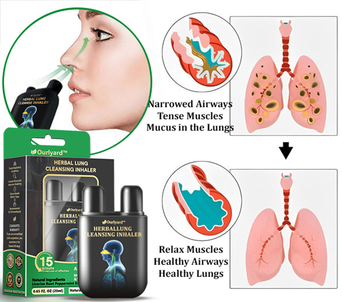 💜✅Official Store:Ourlyard® Herbal Lung Cleansing Inhaler👨‍⚕️FDA Certification(💝 Cough, wheezing, shortness of breath, sputum, stuffy nose, bronchitis, bronchitis, allergy symptoms, lung discomfort💝)
