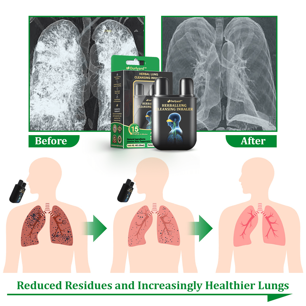 💜✅Official Store:Ourlyard® Herbal Lung Cleansing Inhaler👨‍⚕️FDA Certification(💝 Cough, wheezing, shortness of breath, sputum, stuffy nose, bronchitis, bronchitis, allergy symptoms, lung discomfort💝)