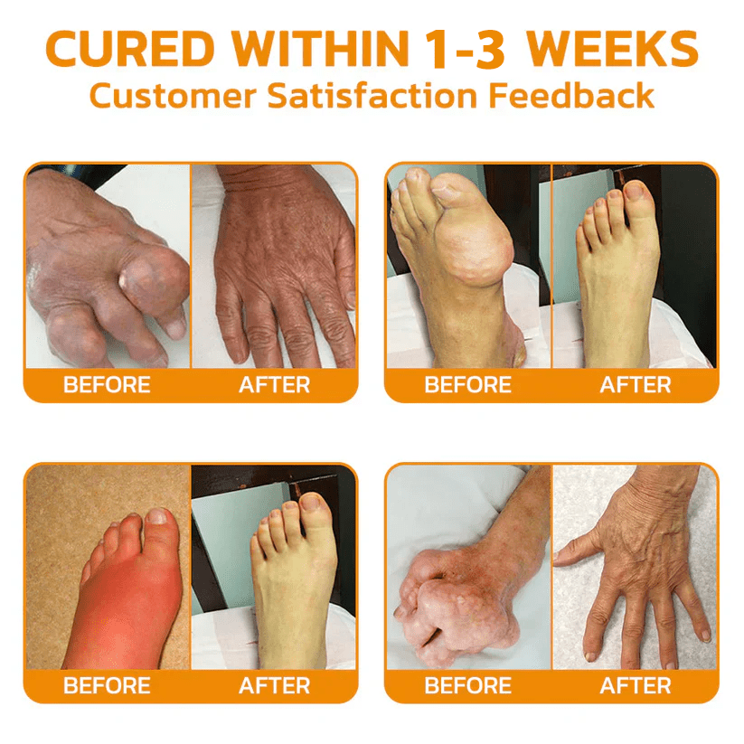 ✅Official Store: flysmus™ Lidocaine Scar-Free Pain Relief Healing Liquid👨‍⚕️USA Osteopathic Medical Association （AAOS）Approved(Reducing joint swelling, pain, stiffness, redness, warmth, soreness,  joint fatigue and remove scars)