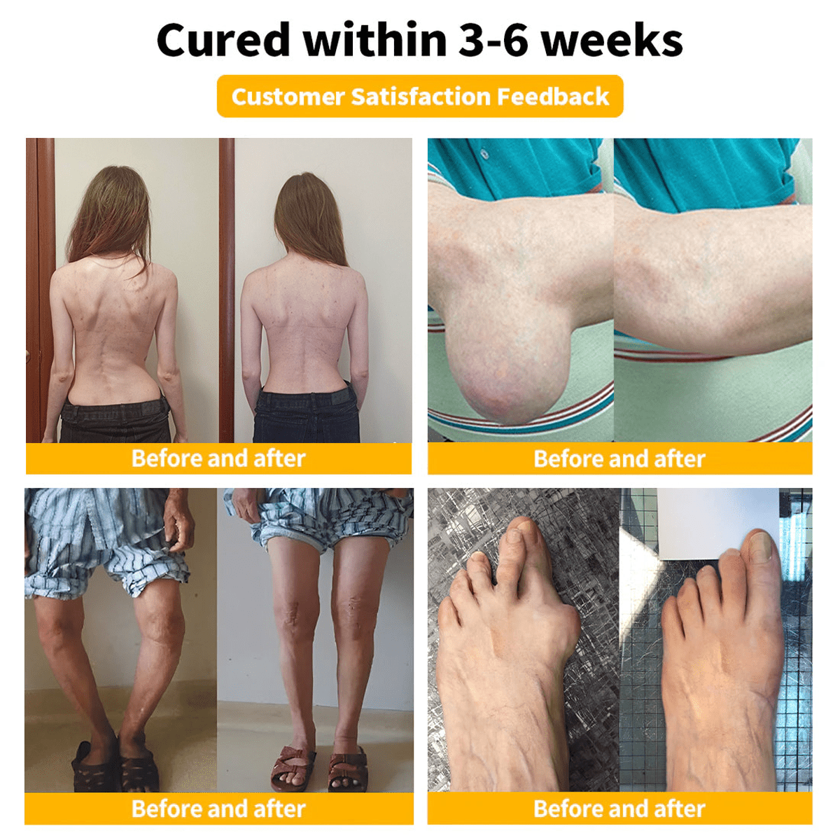 Flysmus™ Bee Venom Pain-Relief Bone Healing Cream🏆🐝 🏆