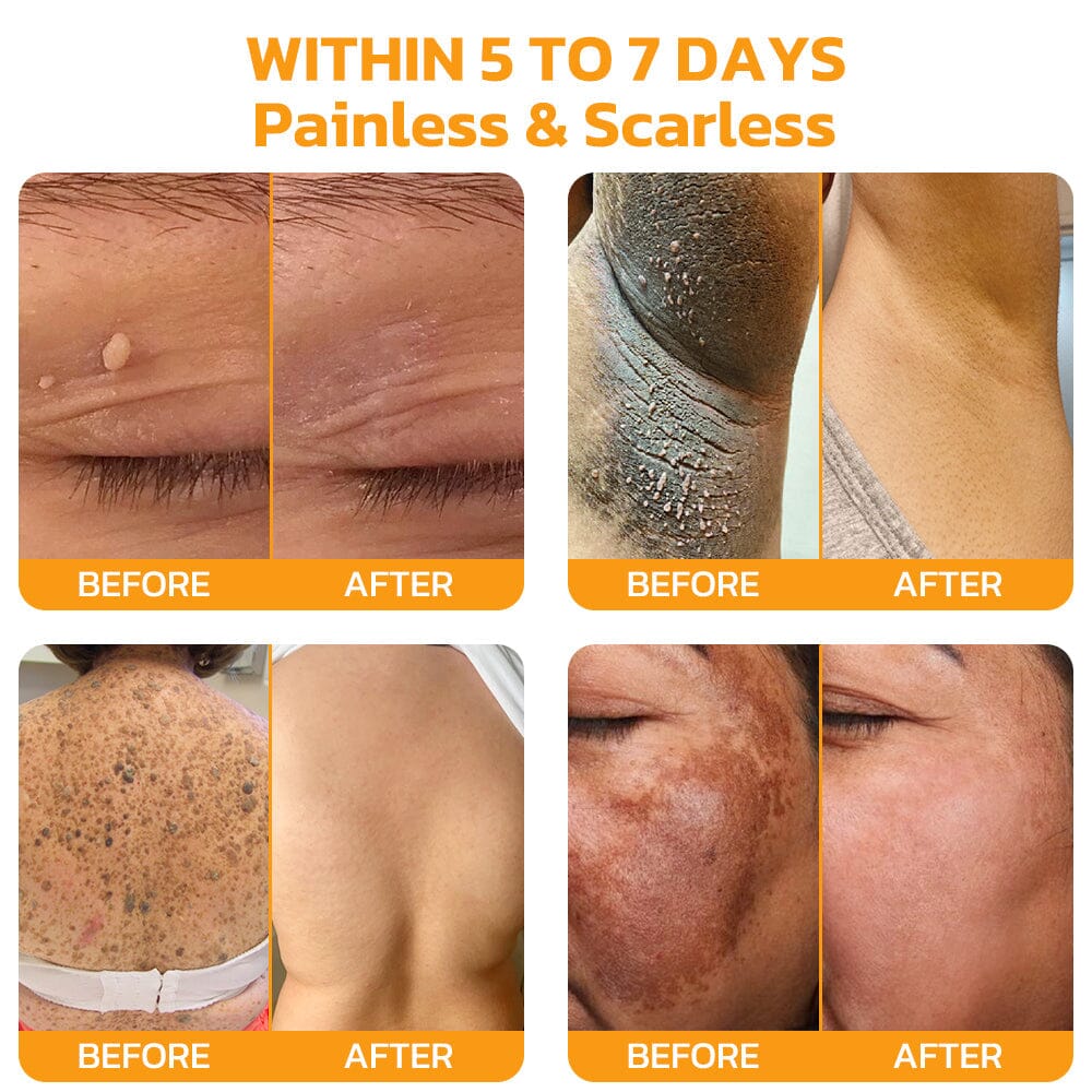 Therapeutic Products Directorate (TPD)✅ Furzero™ Bee Venom Skincare Treatment Pads (⚕️AAD Recommended)